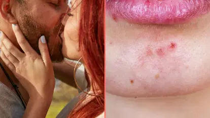 Expert issues grim warning to anyone who kisses bearded men Expert issues grim warning to anyone who kisses bearded men
