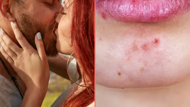 Expert issues grim warning to anyone who kisses bearded men Expert issues grim warning to anyone who kisses bearded men
